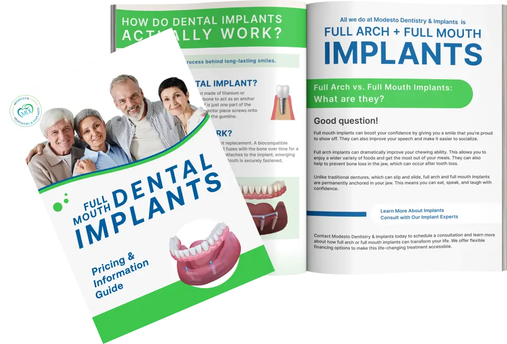 Dental Implant Pricing and Information Guide